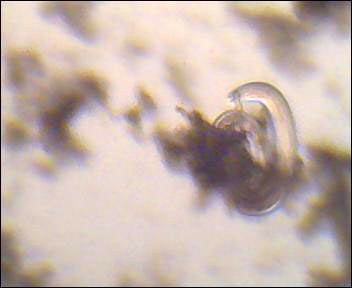 Nematodes indet ?